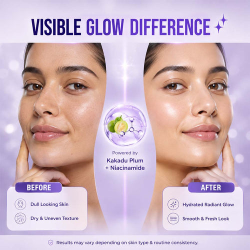 Super Glow Face Serum | 5% Niacinamide | 1% Alpha Arbutin | 25% Kakadu Plum (Vitamin C) -30 ml