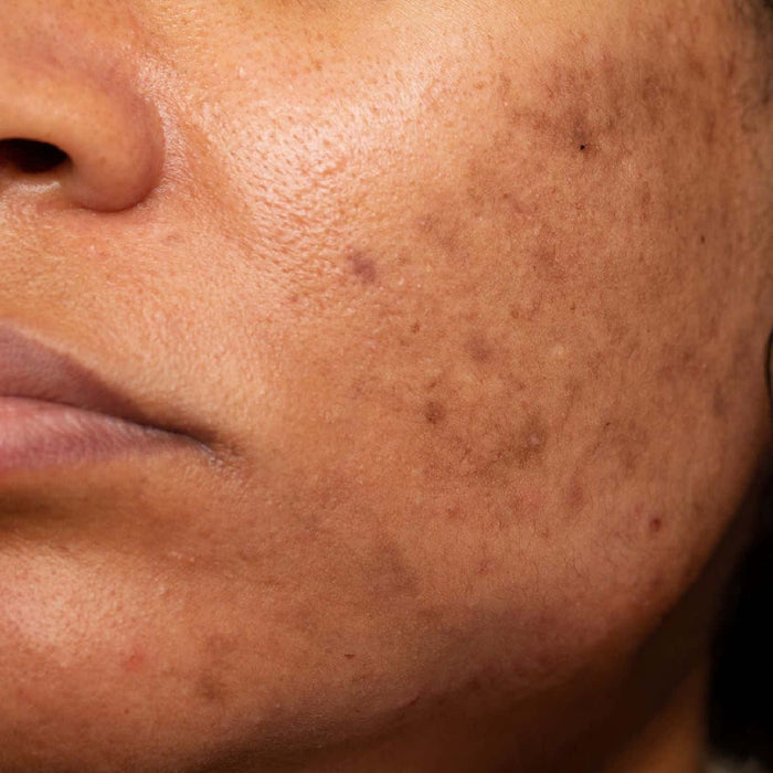 Dark Spots