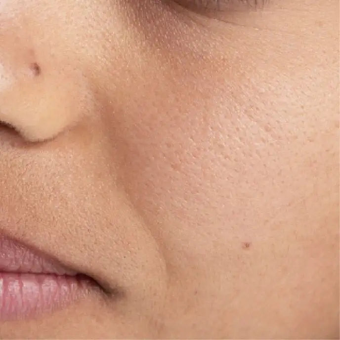 Blurred Pores